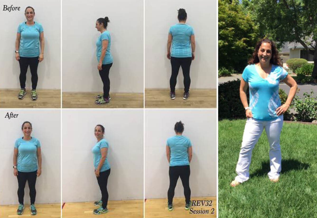 Rev32 participant Stephanie's before and after photos